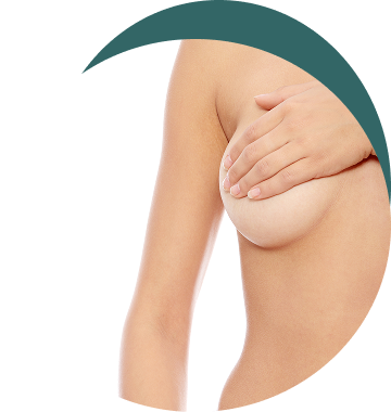 Mastopexia Periareolar Mastopexia Periareolar