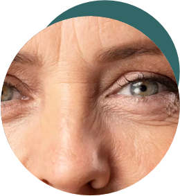blefaroplastia